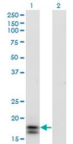 IFNA2 Antibody in Western Blot (WB)