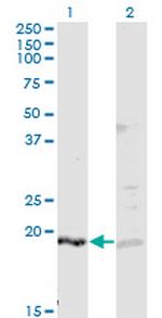 IFNA2 Monoclonal Antibody (2F5)