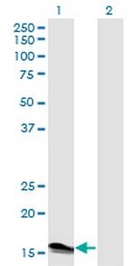 IFNA2 Antibody in Western Blot (WB)
