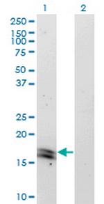 IFNA2 Monoclonal Antibody (1A9)