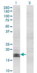 IFNA2 Monoclonal Antibody (1C2)
