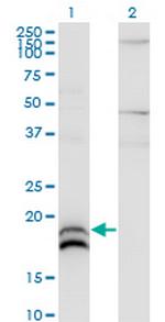 IFNA2 Monoclonal Antibody (4E1)