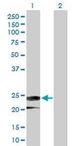 IFNA14 Antibody in Western Blot (WB)