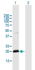 IFNA21 Polyclonal Antibody, MaxPab™
