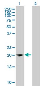 IFNG Antibody in Western Blot (WB)