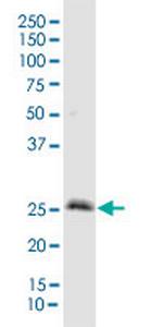IGFBP3 Polyclonal Antibody, MaxPab™