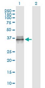IGFBP3 Monoclonal Antibody (2G6)