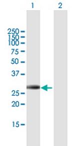IGFBP4 Polyclonal Antibody, MaxPab™