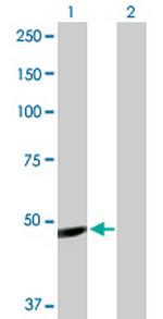 IGHG1 Antibody in Western Blot (WB)