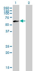 IGHM Antibody in Western Blot (WB)