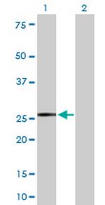 IGKC Antibody in Western Blot (WB)