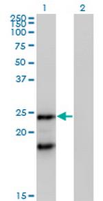 IGLL1 Polyclonal Antibody, MaxPab™