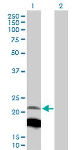 IGLL1 Antibody in Western Blot (WB)