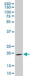 IHH Monoclonal Antibody (2G9)