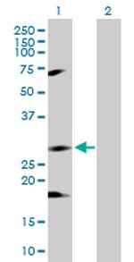 IKBKB Antibody in Western Blot (WB)
