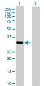IL1A Antibody in Western Blot (WB)