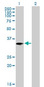 IL1B Antibody in Western Blot (WB)