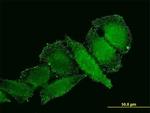 IL1B Antibody in Immunocytochemistry (ICC/IF)