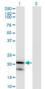 IL1RN Monoclonal Antibody (1H5)