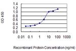 IL1RN Monoclonal Antibody (S14)