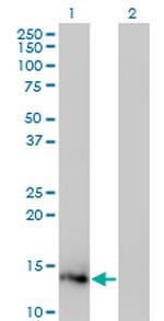 IL2 Antibody in Western Blot (WB)