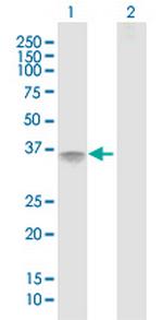 IL2RA Antibody in Western Blot (WB)