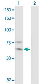 IL2RB Antibody in Western Blot (WB)