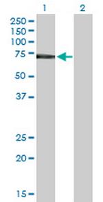 IL2RB Antibody in Western Blot (WB)