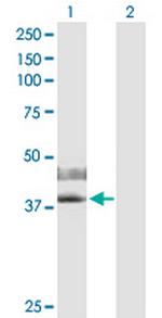 IL2RG Polyclonal Antibody, MaxPab™