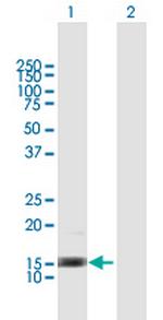 IL3 Antibody in Western Blot (WB)