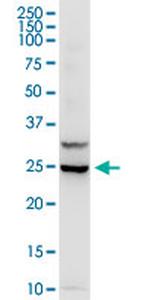 IL3 Antibody in Western Blot (WB)