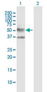 IL3RA Antibody in Western Blot (WB)