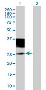 IL4R Antibody in Western Blot (WB)