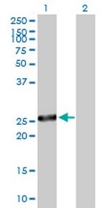 IL6 Antibody in Western Blot (WB)