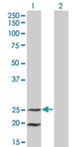 IL6 Antibody in Western Blot (WB)