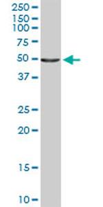 IL6R Antibody in Western Blot (WB)