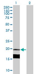 IL7 Antibody in Western Blot (WB)