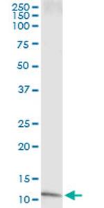 IL8 Antibody in Immunoprecipitation (IP)