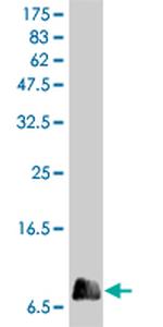 IL8 Monoclonal Antibody (4F1)