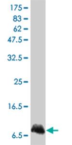 IL8 Antibody in Western Blot (WB)