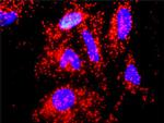IL10 Antibody in Proximity Ligation Assay (PLA) (PLA)