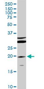 IL10 Antibody in Western Blot (WB)