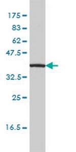 IL11RA Monoclonal Antibody (2D4-F4)
