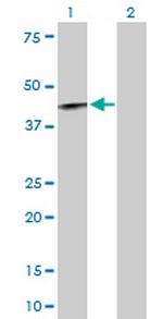 IL12RB1 Polyclonal Antibody, MaxPab™