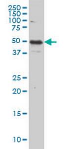 IL13RA2 Monoclonal Antibody (2E10)