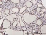 ILF2 Antibody in Immunohistochemistry (Paraffin) (IHC (P))