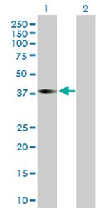 ILF2 Antibody in Western Blot (WB)