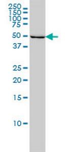 ILK Monoclonal Antibody (4F10)