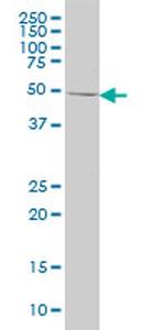 ING1 Antibody in Western Blot (WB)