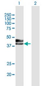 INHA Antibody in Western Blot (WB)